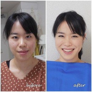 劇的 before & after