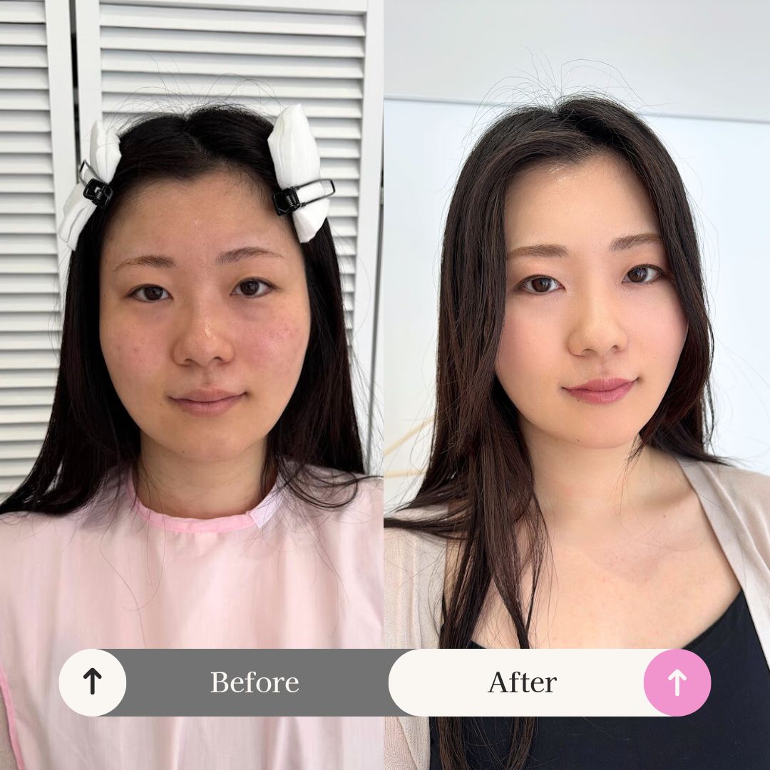 垢抜けメイクレッスン　劇的before & after（東京・青山のサロン ド ルミエール）海保麻里子担当