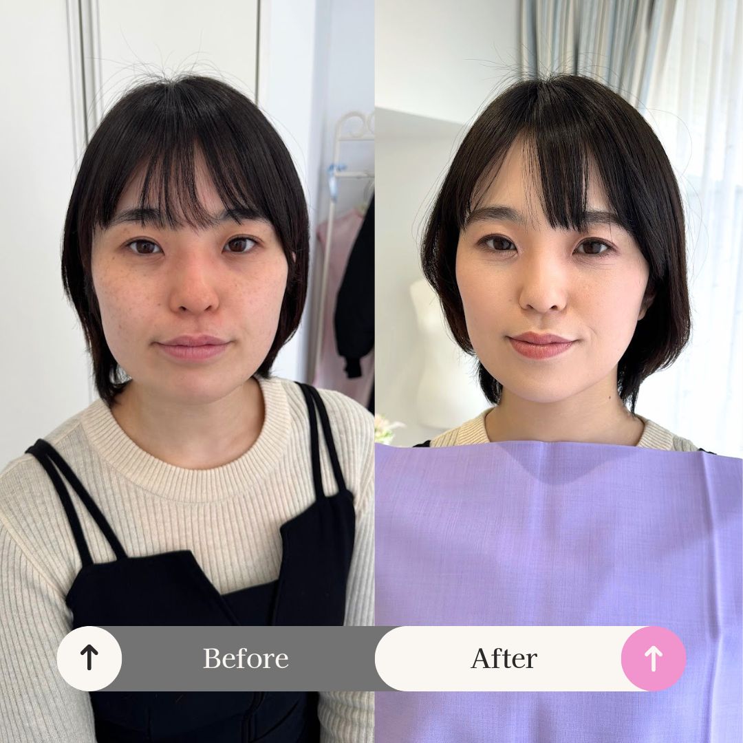 20代トータル診断劇的before & after